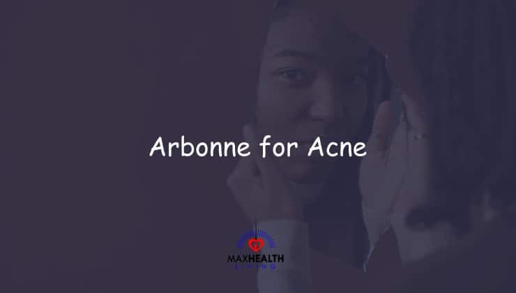 Arbonne for Acne: Does it help? (scars, fash wash, calm line)